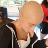 Deretan Potret Megan Domani Botak Saat Perankan Penderita Kanker, Tetap Cantik dan Menarik