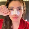 Ini 8 Potret Terbaru Angela Lee Setelah Operasi Hidung