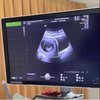 7 Momen Haru atas Kehamilan Aurel Hermansyah, Atta Halilintar Sampai Menangis Lihat Hasil USG!