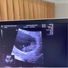 7 Momen Haru atas Kehamilan Aurel Hermansyah, Atta Halilintar Sampai Menangis Lihat Hasil USG!