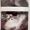 Ini Potret Kehamilan Vanessa Lima yang Jarang Diekspose, Pamer Baby Bumb dan Wajah Sang Anak