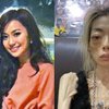 Potret Tragis Wu Zhiheng, Supermodel yang Dinikahi Pria Tajir Kini Kondisinya Berubah Mengenaskan
