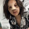 7 Potret Permesta Dhyaz Anak Farida Nurhan Usai Operasi Hidung, Wah Bengkak dan Penuh Perban Bikin Pangling