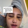 Sudah Lepas Perban, Ini 7 Potret Permesta Dhyaz Anak Farida Nurhan Usai Operasi Hidung 