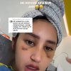 Sudah Lepas Perban, Ini 7 Potret Permesta Dhyaz Anak Farida Nurhan Usai Operasi Hidung 