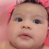 8 Potret Baby Ameena Berendam Pakai ASI, Sebut Milik Kulit Sensitif dan Eksim 
