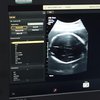 Intip Wajah Bayi di Kandungan, Begini Momen USG Indah Permatasari yang Ditemani Arie Kriting