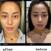Potret 9 Selebriti Sebelum dan Setelah Perawatan Botox, Maia Estianty Jadi Lebih Muda 10 Tahun!