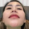 Operasi 3 Kali, Ini 10 Potret Terbaru Farida Nurhan yang Hidungnya Disebut Gagal Oleh Netizen
