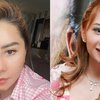 Potret Terbaru Femmy Permatasari Usai Operasi Plastik di Korea, Wajah Makin Cantik dan Kencang