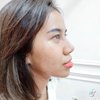 Buka Perban Usai Operasi Plastik Hidung, Ini Potret Mayang Lucyana yang Dipuji Makin Cantik