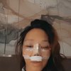 Bunda Corla Pamer Hasil Operasi Plastik di Bagian Hidung, Rekan-rekan Selebriti Puji Makin Cantik