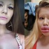 Bosan dengan Kecantikan Alami, Wanita asal Bulgaria ini Lakukan Filler Bibir sampai 43 Kali hingga Penampilannya Jadi Ekstrem