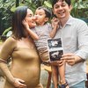 Umumkan Akan Punya Anak Kedua, Ini Deretan Potret Bahagia Andrew Andika & Tengku Dewi Putri Perlihatkan Baby Bump Serta Hasil USG! 