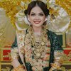 9 Foto Penampilan Putri Isnari dari Lamaran sampai Menikah, Cantiknya Bikin Pangling!