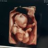 Foto Anisa Rahma Umumkan Kehamilan Kedua, Si Kembar Bahagia Bakal Punya Adik!