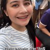 Totalitas, Ini 10 Foto Prilly Latuconsina Pasang Behel Asli Demi Film Barunya