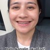 Totalitas, Ini 10 Foto Prilly Latuconsina Pasang Behel Asli Demi Film Barunya