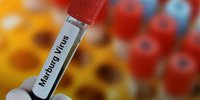 Virus Marburg yang Mematikan Bikin Resah, Ini Fakta, Cara Penularan, Gejala hingga Pencegahannya