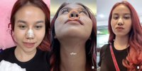 Potret Terbaru Mayang Lucyana Usai Operasi Hidung Kedua, Bentuk Cupingnya Curi Perhatian