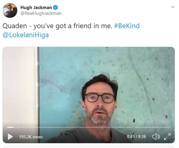 Komentar Hugh Jackman