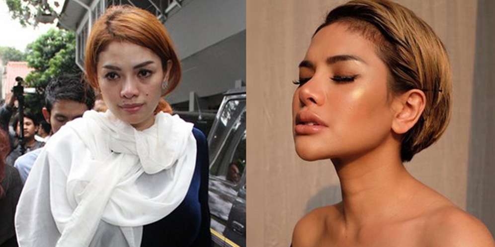 Artis yang Operasi Hidung