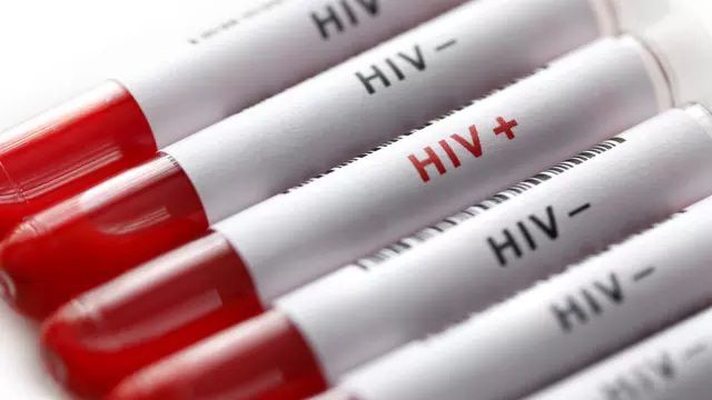 Penyebab HIV AIDS pada Pria dan Wanita