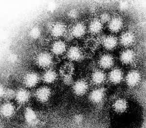 Norovirus Penyebab Muntaber