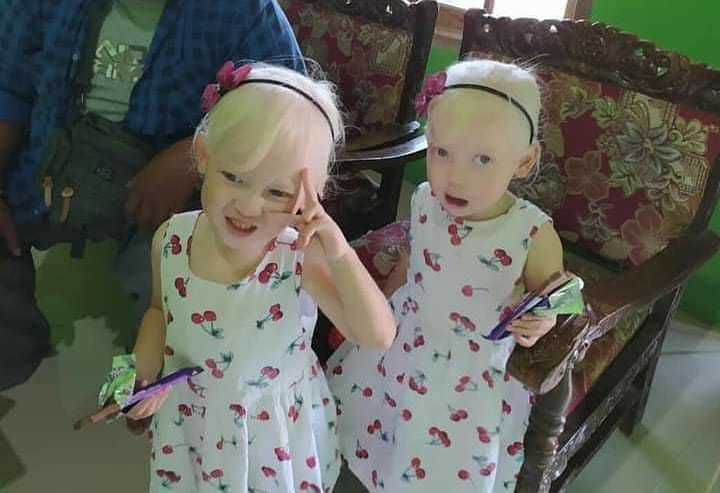 Anak Kembar Mirip Bule di Wonogiri