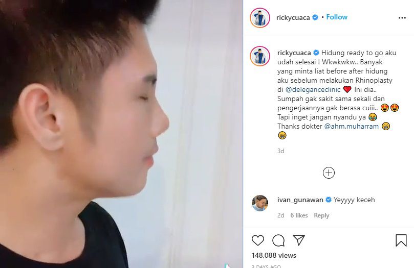 Potret Terbaru Ricky Cuaca Setelah Operasi Hidung yang Makin Mirip Oppa Korea!