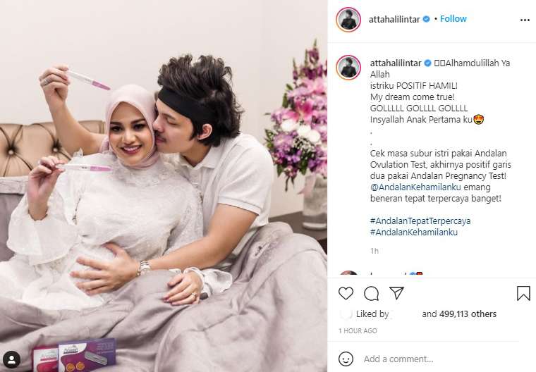 Pengumuman Kehamilan Aurel Hermansyah