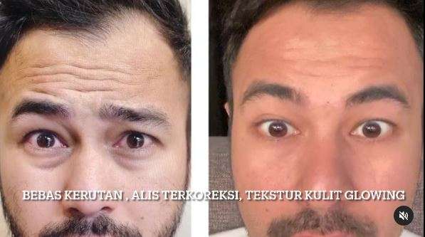 Raffi Ahmad Permak Wajah