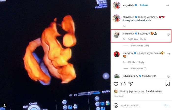 Rizky Billar komentari postingan IG Ali Syakieb