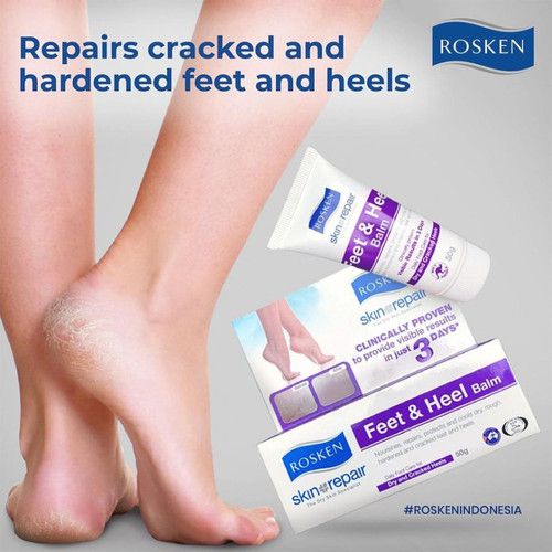 Foot Cream Untuk Tumit Kering Dan Pecah-Pecah - Rosken Feet and Heel Balm