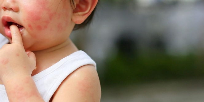 Waspadai 5 Jenis Alergi Kedelai pada Anak