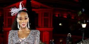 5 Fakta Winnie Harlow, Model Pertama di Dunia dengan Vitiligo