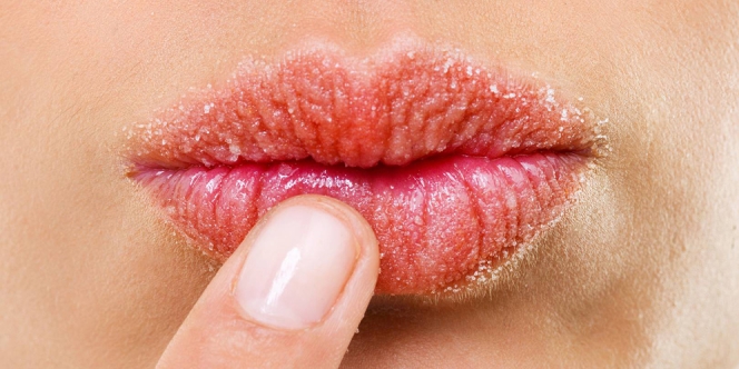16 Cara Mengatasi Bibir Kering, Mengelupas, Pecah-Pecah dan Hitam secara Alami