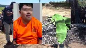 Nggak Mau Dibakar Kayak Orang Ini Kan? Makanya Jangan Body Shaming!