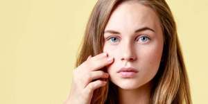 Bye Bye Pimple! Yuk Pakai Rangkaian Acne Treatment dari Derma Angel, Sekalian Buru Diskonnya!
