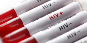 HIV Bisa Menular Melalui Keringat, Hoax atau Fakta Sih?