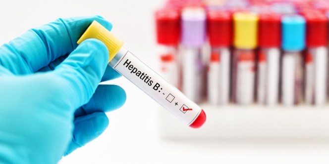Mengenal Penyakit Hepatitis B, Cara Menyembuhkan dan Gejalanya