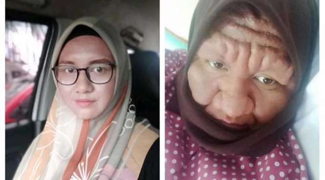 Kaget, Wajah Wanita Cantik Ini Tiba-Tiba Berubah Menjadi Layaknya Nenek Sihir, Ini Kisahnya!