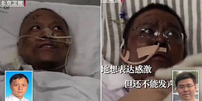 Kulit Dua Dokter di Cina Menjadi Hitam Setelah Positif Terkena Virus Corona