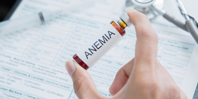 Penyakit Anemia, Penyebab, dan Cara Mengobati