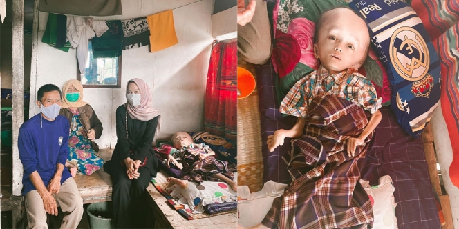 Kisah Pilu Jabarudin, Cacat Fisik Belasan Tahun Hidup dengan Nenek dan Kakek dalam Kemiskinan