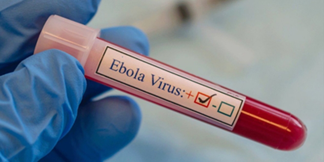 Fakta Kembalinya Virus Ebola Di Tengah Pandemi Covid-19, Apakah Mengancam Seluruh Dunia?