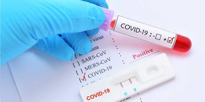 Salah Kira Diagnosis CVD dengan COVID-19, Keluarga Pasien Ini Ngamuk di Medsos!