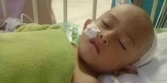 Tertimpa Pagar Besi saat Gempa, Otak Gadis Kecil Ini Bernanah hingga Operasi Gagal Jantung Dua Kali