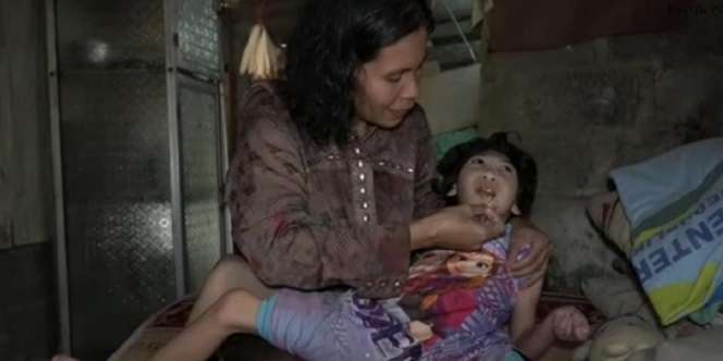 Cerita Pilu Anak Ibu Imas Alami Disabilitas Sejak Lahir, Sering Diejek Orang sampai Dikatain Monyet