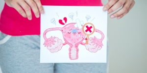 Penyebab Kanker Rahim pada Wanita, Apakah Minum Es saat Haid Jadi Salah Satunya?